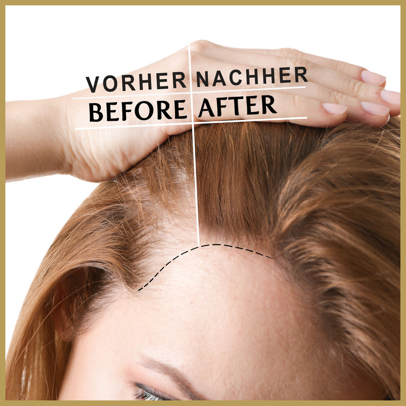 haarpflege männer, shampoo haarwachstum, haare wachsen schneller, gegen haarausfall frauen, haar wachstumsbeschleuniger, shampoo juckende kopfhaut, antischuppenshampoo frauen, feuchtigkeitsshampoo, haare wachstum, shampoo ohne silikone, hitzeschutzspray für haare, gegen haarausfall, kreatin haare, haarshampoo ohne silikone und parabene, hair growth shampoo, haarwuchs shampoo, haarkur strapaziertes haar, knoblauchöl, anti haarausfall, schampoo für frauen, 